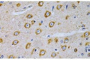 Immunohistochemistry of paraffin-embedded Rat brain using OLR1 Polyclonal Antibody at dilution of 1:200 (40x lens). (OLR1 抗体)