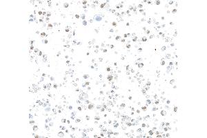 Immunocytochemistry (ICC) image for anti-AT Rich Interactive Domain 1B (SWI1-Like) (ARID1B) (AA 1425-1475) antibody (ABIN7795694) (Recombinant ARID1B 抗体  (AA 1425-1475))