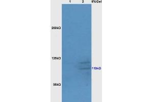 Lane 1: mouse liver lysates Lane 2: mouse brain lysates probed with Anti Bub1 Polyclonal Antibody, Unconjugated (ABIN706541) at 1:200 in 4 °C. (BUB1 抗体  (AA 951-1085))