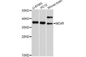 Western blot analysis of extracts of various cell lines, using MC4R Antibody. (MC4R 抗体  (AA 1-100))