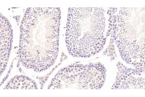 Detection of IL25 in Mouse Testis Tissue using Polyclonal Antibody to Interleukin 25 (IL25) (IL-25 抗体  (AA 32-148))