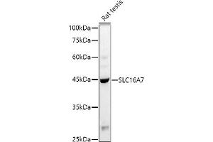 Western blot analysis of extracts of Rat testis, using (ABIN6134859, ABIN6147861, ABIN6147862 and ABIN6215999) at 1:1000 dilution. (SLC16A7 抗体  (C-Term))