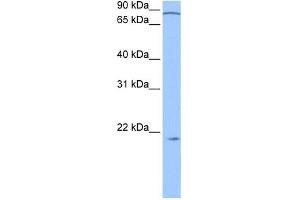 Western Blotting (WB) image for anti-Actin Related Protein 2/3 Complex, Subunit 3, 21kDa (ARPC3) (N-Term) antibody (ABIN631647)