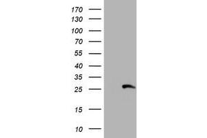 Western Blotting (WB) image for anti-Regulatory Factor X-Associated Ankyrin Containing Protein (RFXANK) antibody (ABIN1500683) (RFXANK 抗体)