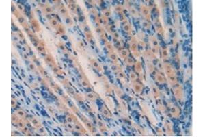IHC-P analysis of Mouse Stomach Tissue, with DAB staining. (SOD2 抗体  (AA 25-222))