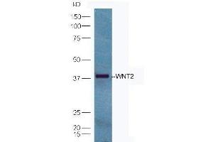 Western Blotting (WB) image for anti-Wingless-Type MMTV Integration Site Family Member 2 (WNT2) (AA 221-320) antibody (ABIN762896)