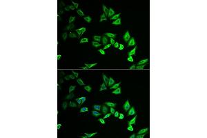 Immunofluorescence analysis of U2OS cells using MYOZ2 antibody (ABIN6129772, ABIN6144299, ABIN6144300 and ABIN6222126). (MYOZ2 抗体  (AA 1-264))