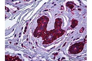 Anti-MYH9 antibody IHC of human breast.