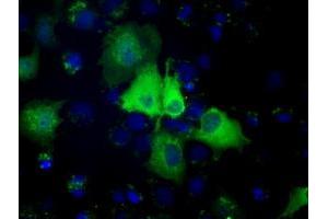 Anti-PSMC3 mouse monoclonal antibody (ABIN2453538) immunofluorescent staining of COS7 cells transiently transfected by pCMV6-ENTRY PSMC3 (RC201790). (PSMC3 抗体)