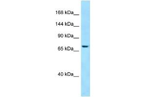 WB Suggested Anti-SBF1 Antibody Titration: 1.