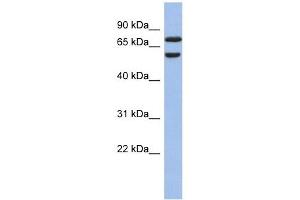 GNL3L antibody used at 1 ug/ml to detect target protein. (GNL3L 抗体)