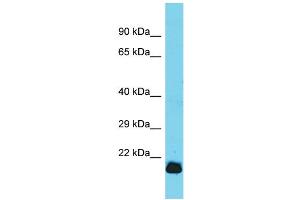 Host: Rabbit  Target Name: Gpx7  Sample Tissue: Rat Heart lysates  Antibody Dilution: 1. (Glutathione Peroxidase 7 抗体  (C-Term))