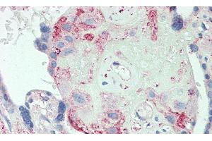 Immunohistochemistry (IHC) image for anti-Orosomucoid 2 (ORM2) (AA 19-207) antibody (ABIN7436921)