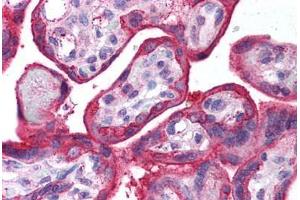 Human Placenta (formalin-fixed, paraffin-embedded) stained with EGFR antibody ABIN218581 at 1:500 followed by biotinylated goat anti-rabbit IgG secondary antibody ABIN481713, alkaline phosphatase-streptavidin and chromogen. (EGFR 抗体  (AA 1166-1180))