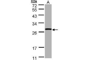 WB Image Sample (30 ug of whole cell lysate) A: Hep G2 , 10% SDS PAGE antibody diluted at 1:1000 (GSTT1 抗体)