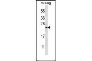 Western blot analysis of RHEBL1 (N-term) in Mouse lung tissue lysates (35ug/lane). (RHEBL1 抗体  (N-Term))