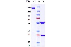 Anti-ICOS / CD278 Reference Antibody (feladilimab) on SDS-PAGE under reducing (R) condition. (Recombinant ICOS (Feladilimab Biosimilar) 抗体)