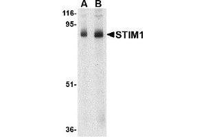 Western Blotting (WB) image for anti-Stromal Interaction Molecule 1 (STIM1) (C-Term) antibody (ABIN1030706) (STIM1 抗体  (C-Term))
