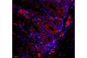 Immunofluorescence of paraffin embedded mouse rectum using WDR81 (ABIN7076221) at dilution of 1: 700 (400x lens) (WDR81 抗体)