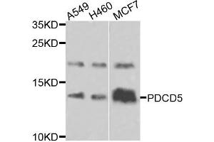 Western blot analysis of extracts of various cells, using PDCD5 antibody. (PDCD5 抗体)