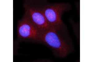 IF analysis of c-Rel/REL using anti-c-Rel/REL antibody (ABIN7599778).