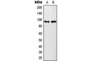 Western blot analysis of PLA2G4A (pS505) expression in HeLa lambda protein phosphatase-treated (A), NIH3T3 lambda protein phosphatase-treated (B) whole cell lysates. (PLA2G4A 抗体  (pSer505))