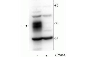 Western blot of OCIAML2 lysate showing specific immunolabeling of the ~51 kDa MEF2C phosphorylated at Ser222 in the first lane (-). (MEF2C 抗体  (pSer222))
