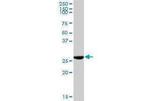 KHK MaxPab rabbit polyclonal antibody. (Ketohexokinase 抗体  (AA 1-298))