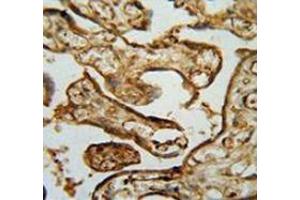 Immunohistochemistry (Paraffin-embedded Sections) (IHC (p)) image for anti-Membrane Protein, Palmitoylated 1, 55kDa (MPP1) (AA 304-331), (Middle Region) antibody (ABIN953491)