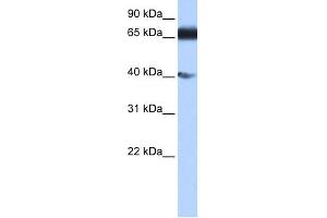 WB Suggested Anti-DKFZp686E2433 Antibody Titration:  0. (ZNF879 抗体  (N-Term))
