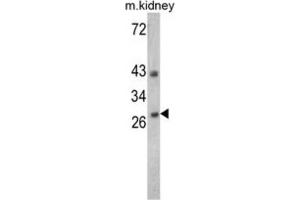 Western Blotting (WB) image for anti-Endonuclease G (ENDOG) antibody (ABIN3002690)