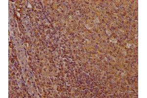 Immunohistochemistry (IHC) image for anti-CD19 Molecule (CD19) (AA 20-291) antibody (ABIN7147133)