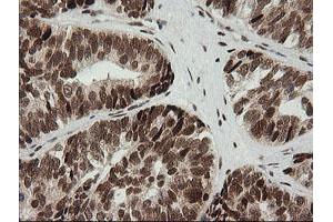 Image no. 4 for anti-Zinc Finger and SCAN Domain Containing 18 (ZSCAN18) antibody (ABIN1501858)