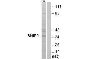 Western blot analysis of extracts from Jurkat cells, using BNIP2 antibody.