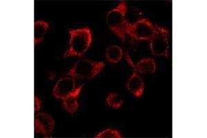 Immunofluorescence (IF) image for anti-Interleukin 23 (IL23) antibody (ABIN2665148) (IL23 抗体)