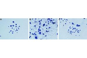 NGF-induced neurite outgrowth neutralizing assayPC12 cells were grown on collagen-coated plates. (Nerve Growth Factor 抗体)