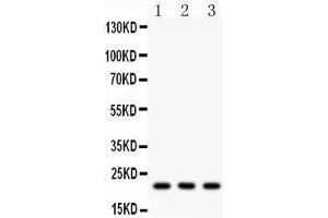 Western Blotting (WB) image for anti-Syndecan 4 (SDC4) (AA 172-198), (C-Term) antibody (ABIN3043323) (SDC4 抗体  (C-Term))