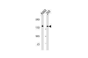DHX9 Antibody (N-term) (ABIN1881260 and ABIN2843377) western blot analysis in K562 and 293 cell line lysates (35 μg/lane). (DHX9 抗体  (N-Term))