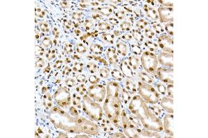 Immunohistochemistry of paraffin-embedded mouse kidney using RBM3 Rabbit mAb (ABIN7270084) at dilution of 1:25 (40x lens). (RBM3 抗体)