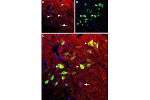 Expression of B2 bradykinin receptor in mouse spinal cord - Immunohistochemical staining of mouse spinal cord using Anti-B2 Bradykinin Receptor (BDKRB2) Antibody (ABIN7042968, ABIN7043942 and ABIN7043943). (BDKRB2 抗体  (C-Term, Intracellular))