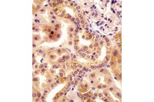 (ABIN655484 and ABIN2845005) staining RSBN1 in human kidney tissue sections by Immunohistochemistry (IHC-P - paraformaldehyde-fixed, paraffin-embedded sections). (RSBN1 抗体  (N-Term))