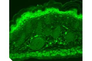 Immunohistochemistry (IHC) image for anti-Transient Receptor Potential Cation Channel, Subfamily V, Member 3 (TRPV3) (AA 774-791) antibody (Atto 390) (ABIN2485351)