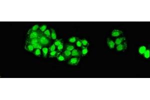 Immunofluorescent analysis of PC-3 cells using ABIN7151588 at dilution of 1:100 and Alexa Fluor 488-congugated AffiniPure Goat Anti-Rabbit IgG(H+L)