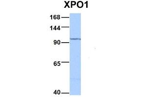 Host:  Rabbit  Target Name:  XPO1  Sample Type:  HepG2  Antibody Dilution:  1. (XPO1 抗体  (C-Term))