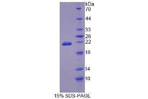 SDS-PAGE analysis of Rat OSTM1 Protein.