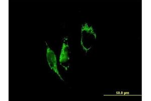 Immunofluorescence of purified MaxPab antibody to PYCR1 on HeLa cell. (PYCR1 抗体  (AA 1-319))