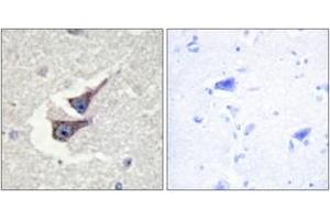 Immunohistochemistry analysis of paraffin-embedded human brain, using Catalase (Phospho-Tyr385) Antibody.