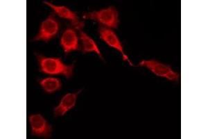 ABIN6276035 staining 293T by IF/ICC. (GPR35 抗体  (Internal Region))