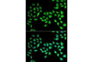 Immunofluorescence analysis of U2OS cell using UCN2 antibody. (Urocortin 2 抗体)