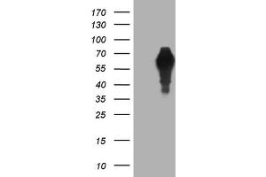Western Blotting (WB) image for anti-alpha-Fetoprotein (AFP) (AA 19-397) antibody (ABIN2716008)